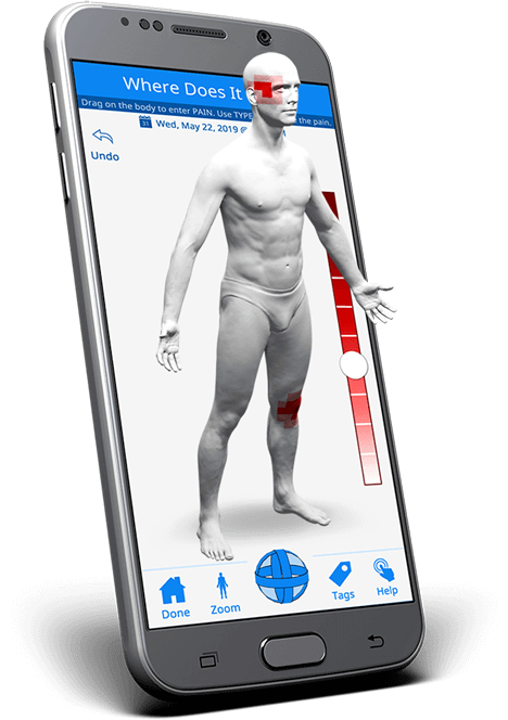 geopain pain mobile app